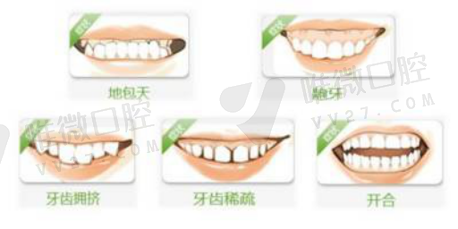种牙价位对应假牙区别大吗,假牙有几种(图1)